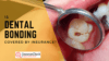 Is dental bonding covered by insurance?