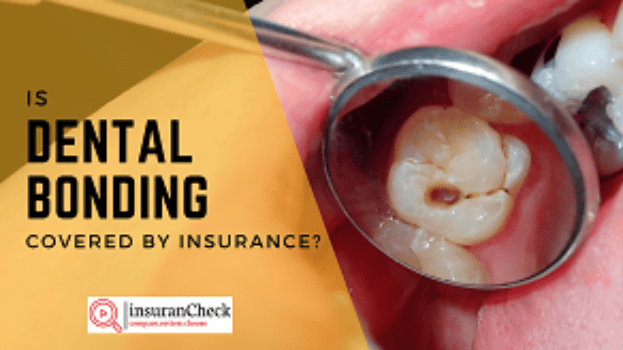 Is dental bonding covered by insurance?
